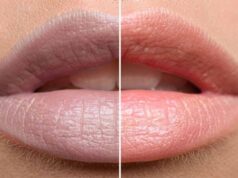 काले होंठों को नेचुरली गुलाबी बनाएंगे ये 7 घरेलू नुस्खे, महंगे लिप बाम की नहीं पड़ेगी जरूरत